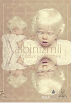 Albinizmli Bir Çocuk Yetiştirmek